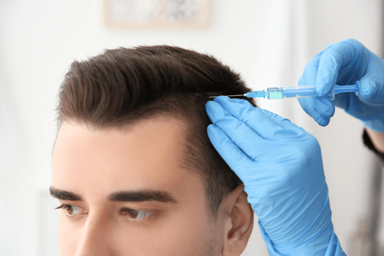 درمان ریزی مو در زنان