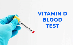 آزمایش ویتامین D خون